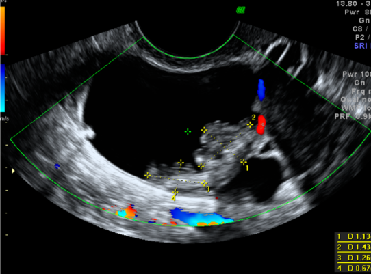 IOTA Corse in Visakhapatnam |