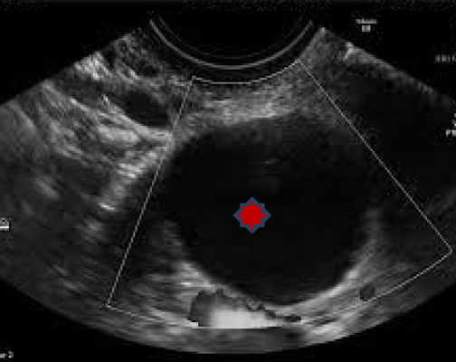 IOTA Corse in Visakhapatnam |