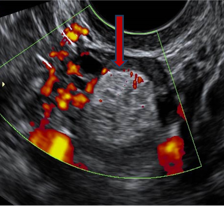 IOTA Corse in Visakhapatnam |